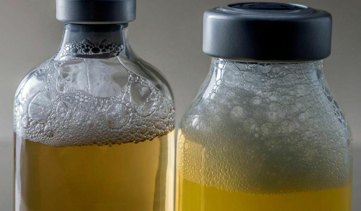 Why Do Diabetics Pee So Much?