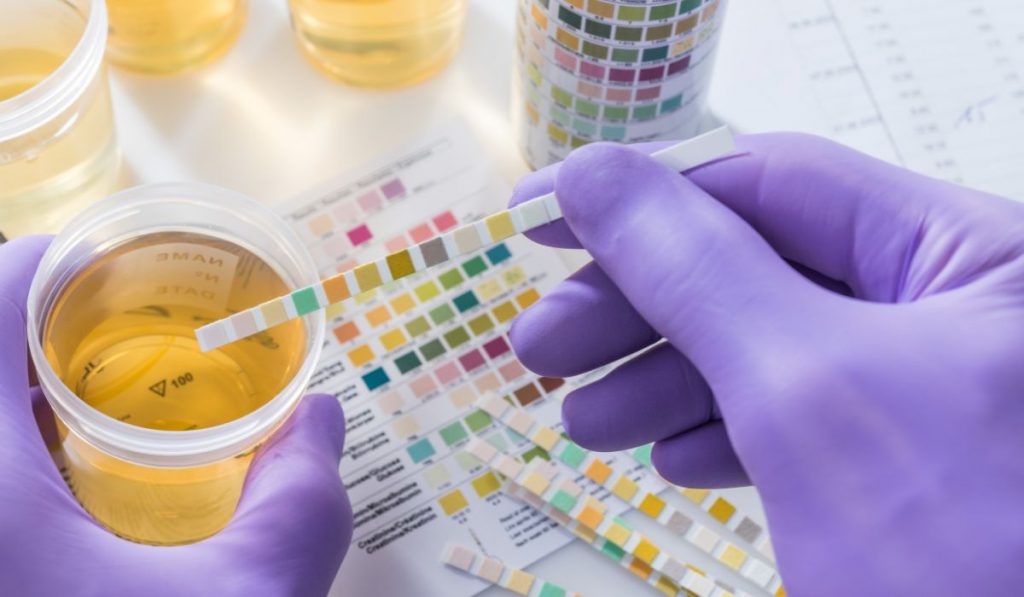 why do diabetics pee so much